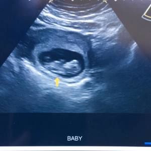 Meet your Posher, Tia